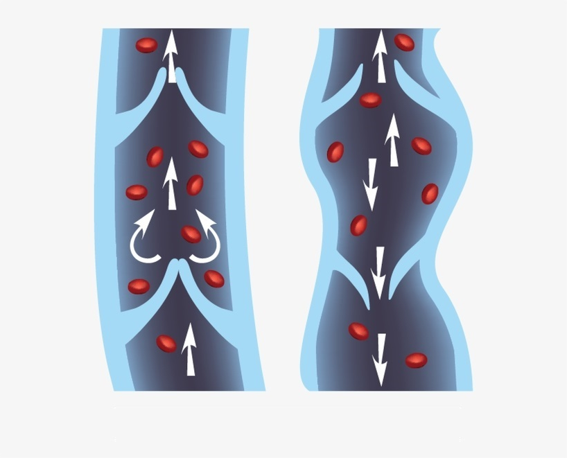 how the vein valve apparatus works