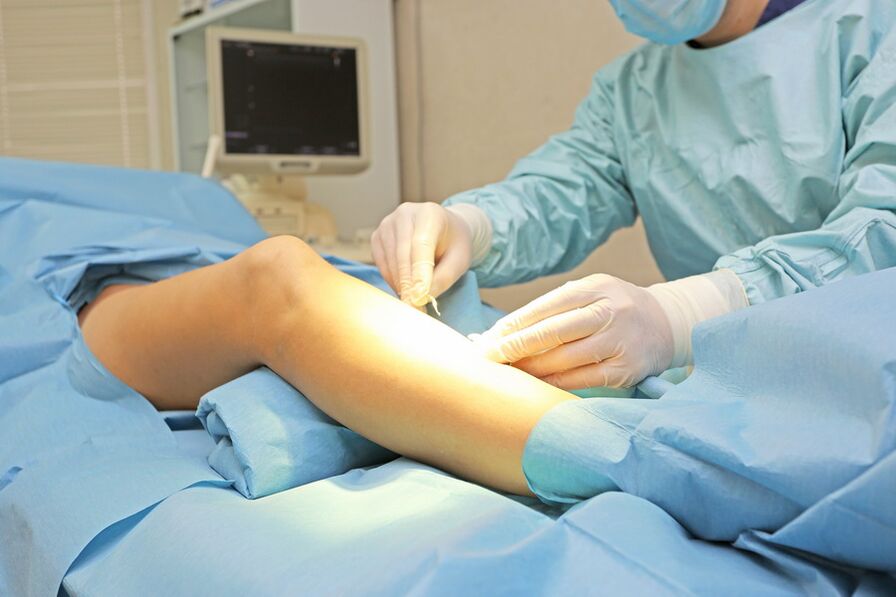 modern treatment of varicose veins