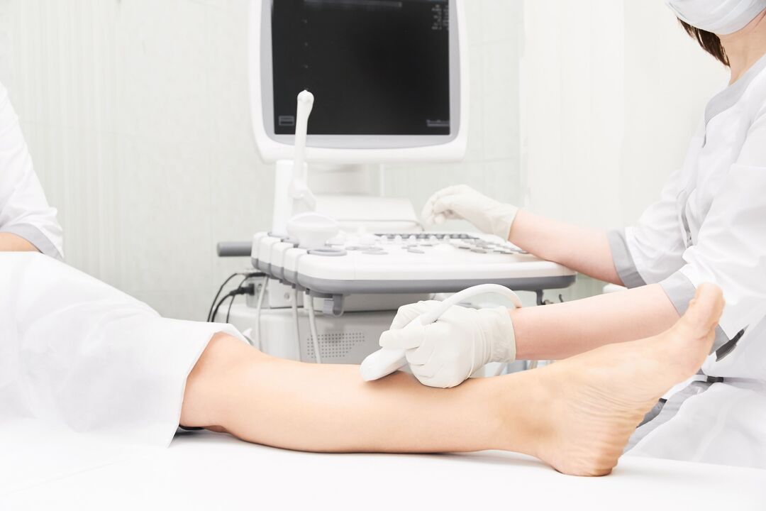 ultrasound diagnostics of varicose veins